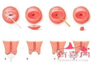 澳门58岁借腹生子-腹腔疾病是否影响生育？